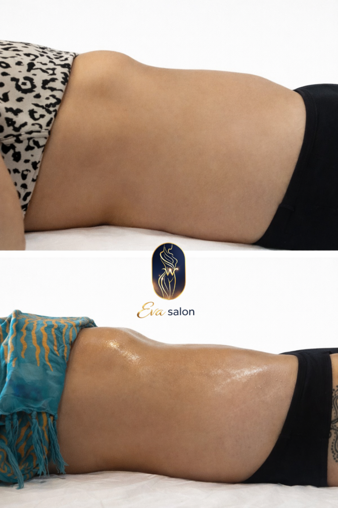 Proměna oblasti břicha po manuální lymfomodelaci v Eva Salon